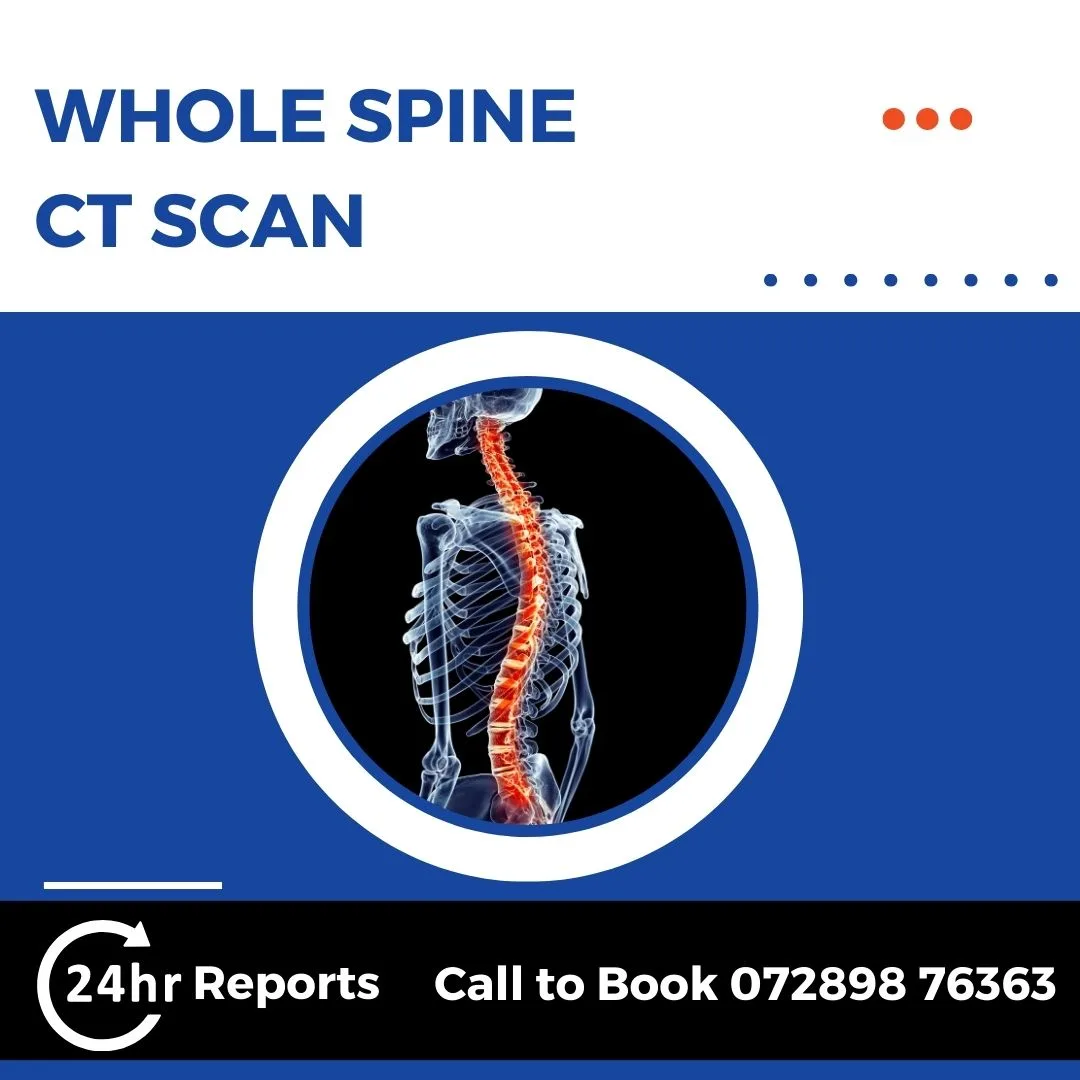 Whole Spine CT Scan