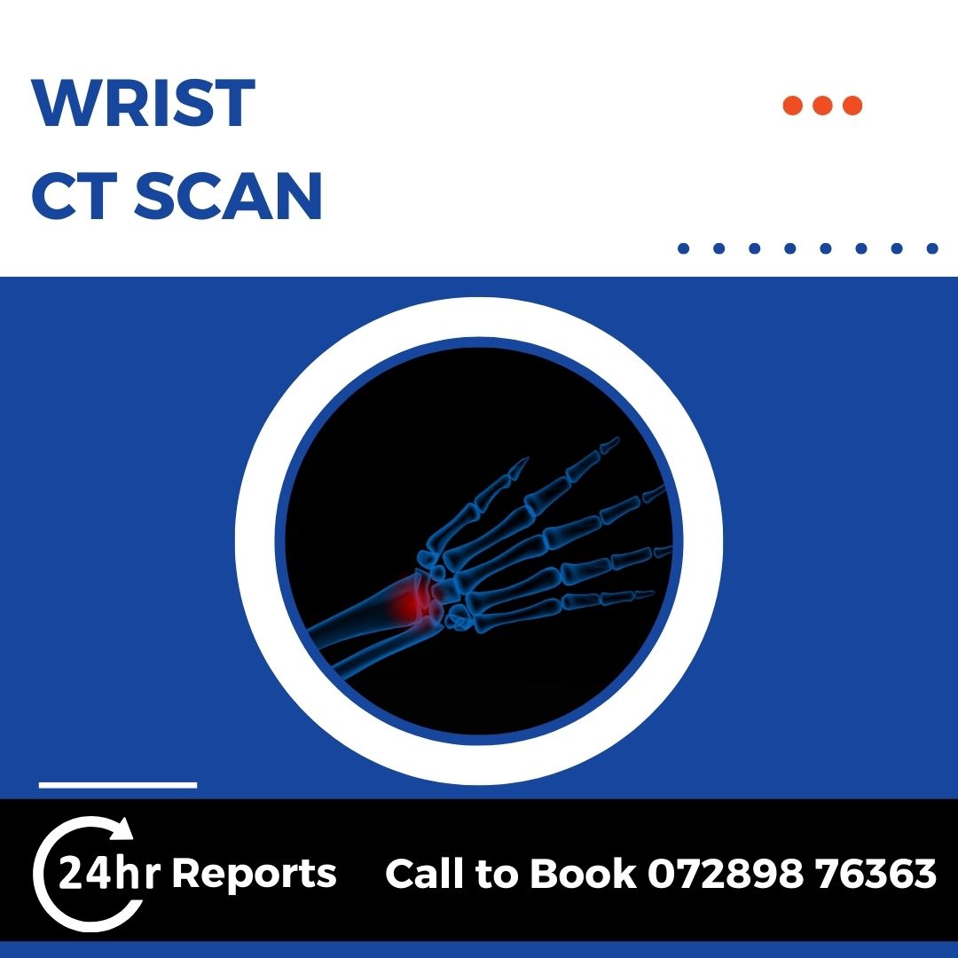 Wrist CT Scan