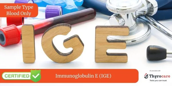 Immunoglobulin E (IGE) Test