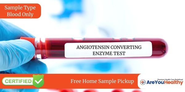 ANGIOTENSIN CONVERTING ENZYME TEST