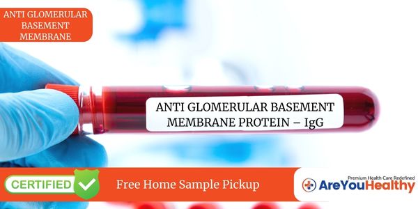 ANTI GLOMERULAR BASEMENT MEMBRANE PROTEIN – IgG Test