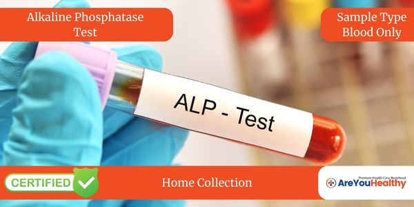 Alkaline Phosphatase Test