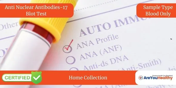 Anti Nuclear Antibodies-17 Blot Test