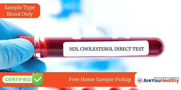 HDL CHOLESTEROL DIRECT TEST