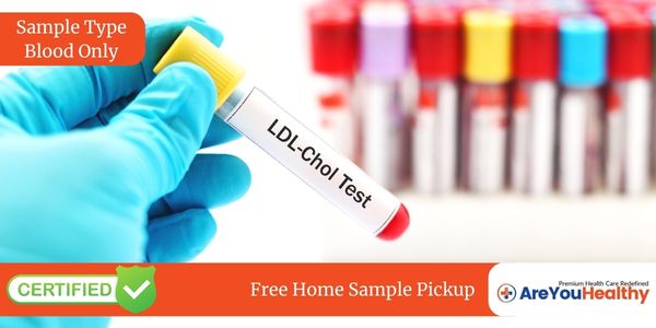 LDL CHOLESTEROL DIRECT TEST