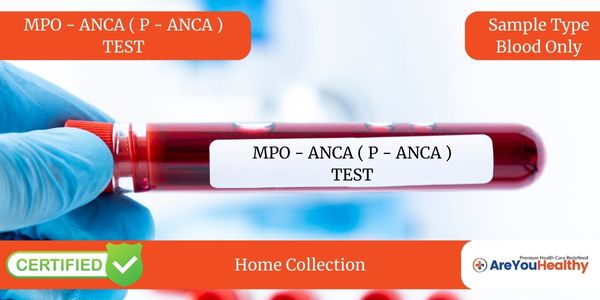 MPO - ANCA ( P - ANCA ) TEST