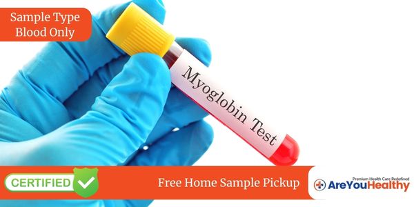 MYOGLOBIN Test