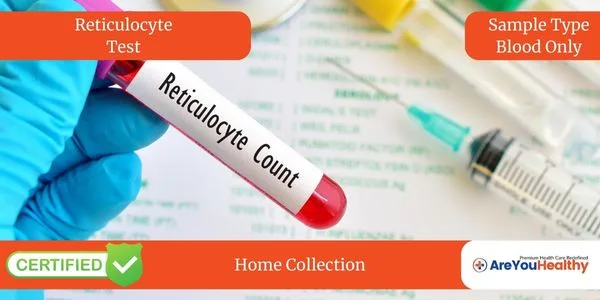 Reticulocyte Test