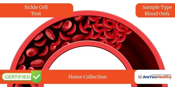 Sickle Cell Test