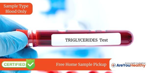 TRIGLYCERIDES Test