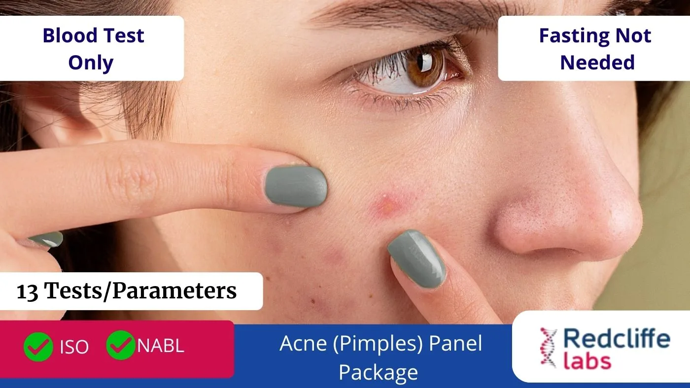 Acne (Pimples) Panel