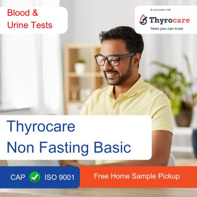 Thyrocare Non Fasting Basic