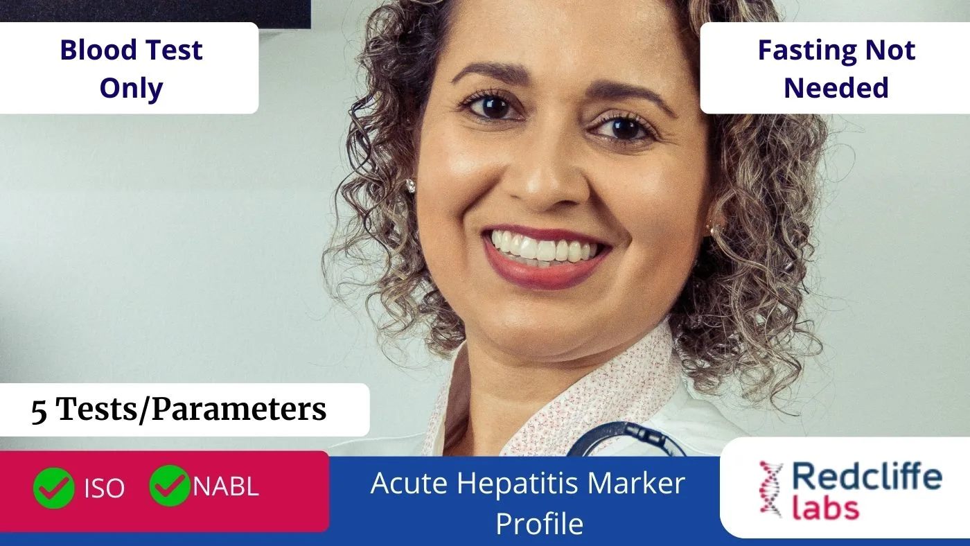 Acute Hepatitis Marker Profile