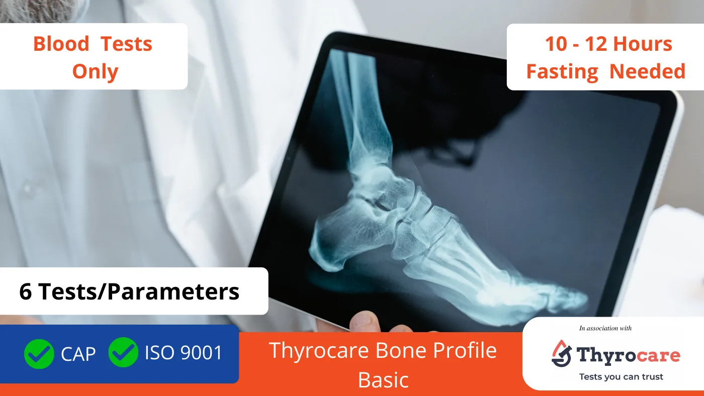 Thyrocare Bone Profile Basic