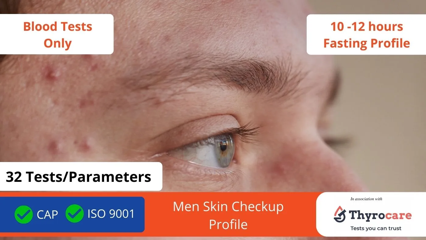 Thyrocare Men Skin Care Checkup Profile