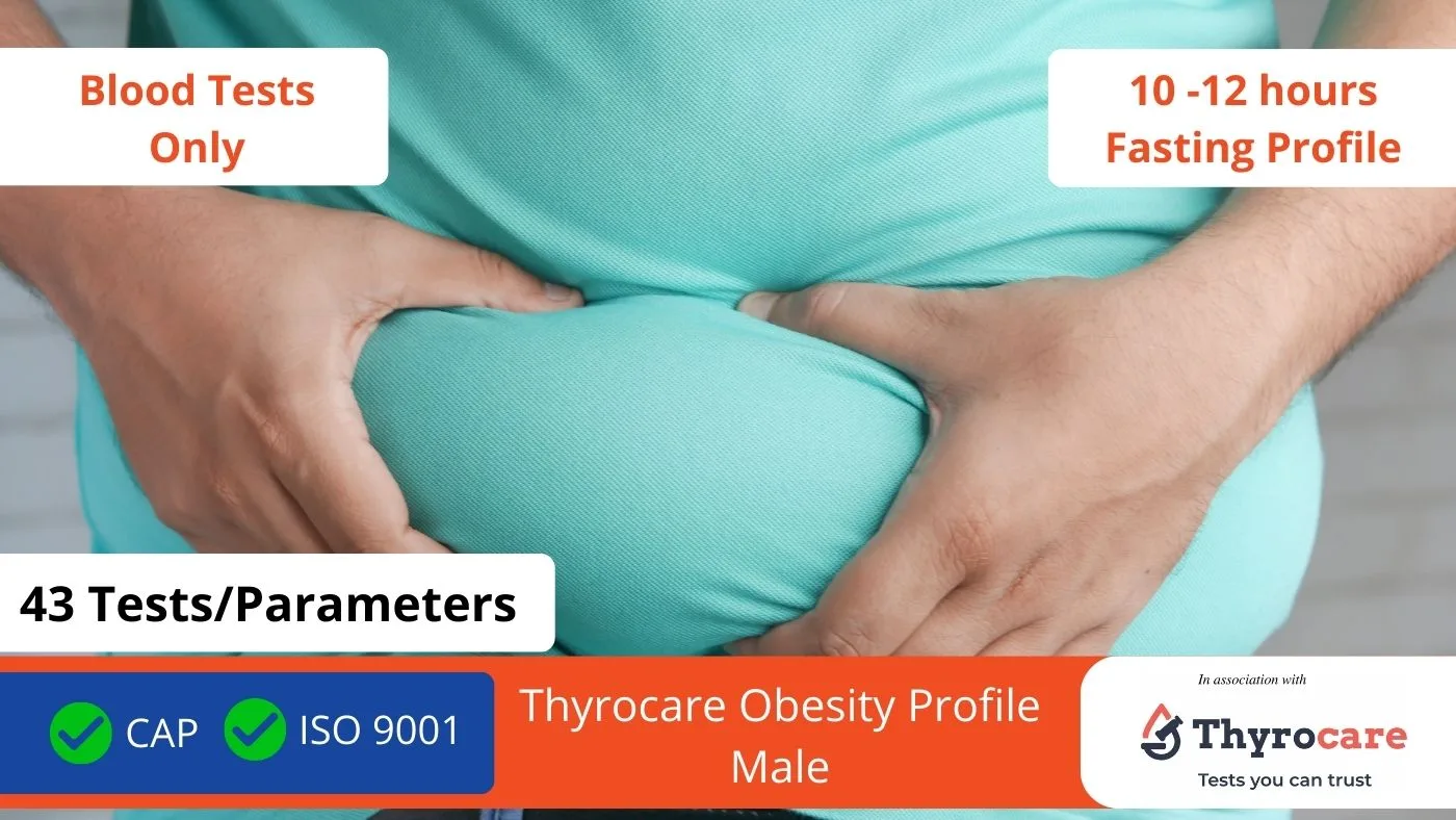 Thyrocare Obesity Profile Male