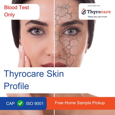 Thyrocare Skin Profile