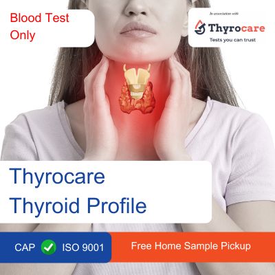 Thyrocare Thyroid Profile